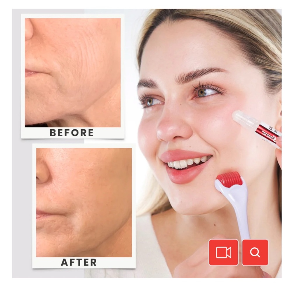 Plasmasomes Skin Cell Solution System